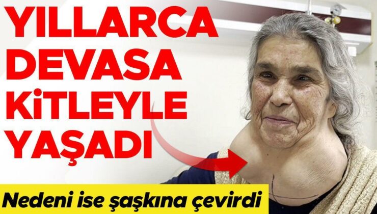 Doktordan korktuğu için 50 yıldır devasa kitleyle yaşadı! Ameliyat sonrası ilk sözleri ‘Korkulacak bir şey yokmuş’ oldu